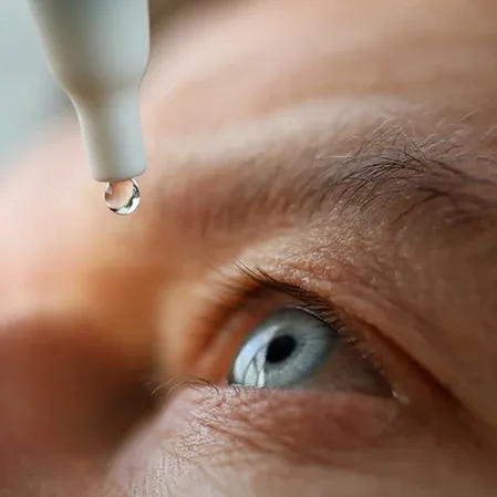 Close-up of an eye receiving a drop from an applicator, illustrating an eye care or treatment procedure.